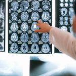AI MI mesterséges intelligencia eglszslg egészségügy orvos orvostudomány kép képalkotás MRI