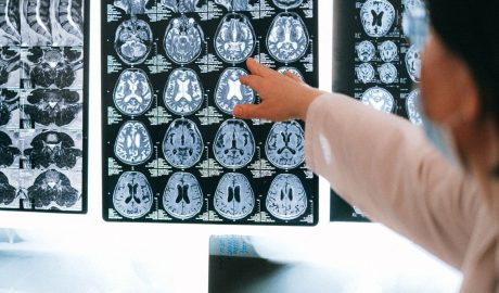 AI MI mesterséges intelligencia eglszslg egészségügy orvos orvostudomány kép képalkotás MRI