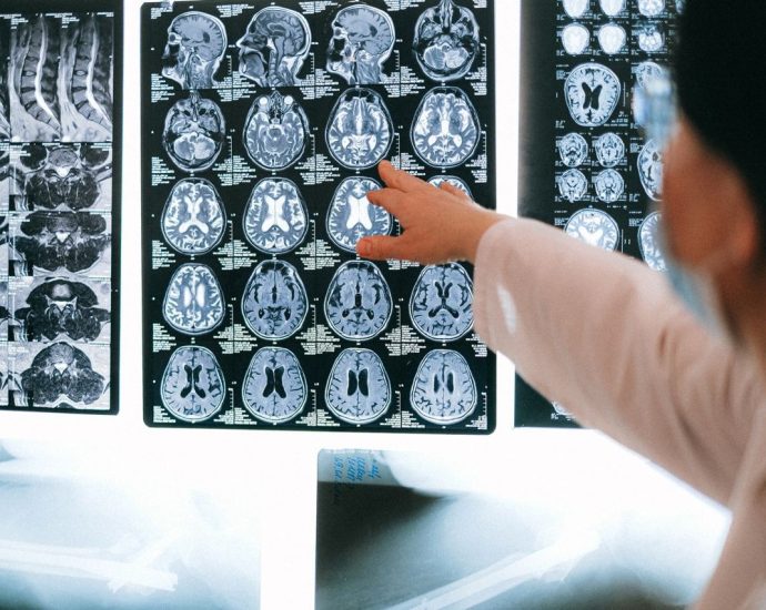 AI MI mesterséges intelligencia eglszslg egészségügy orvos orvostudomány kép képalkotás MRI