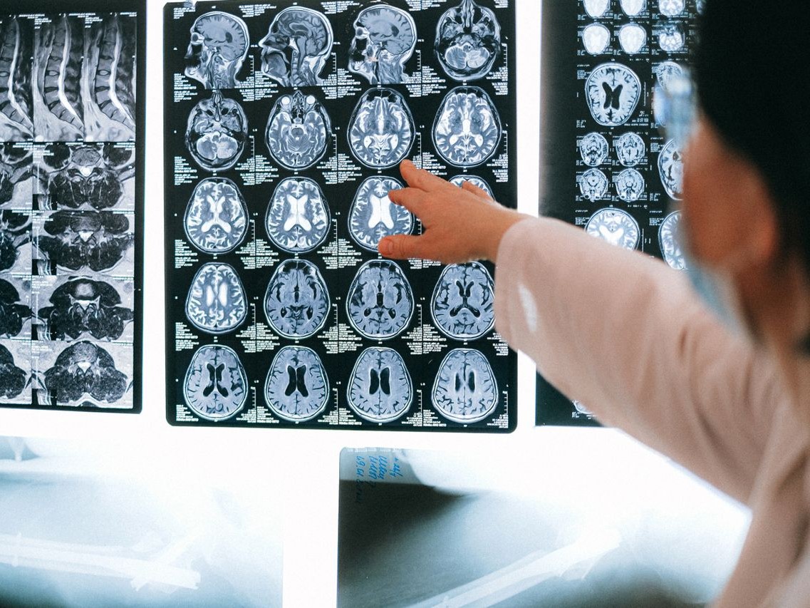 AI MI mesterséges intelligencia eglszslg egészségügy orvos orvostudomány kép képalkotás MRI